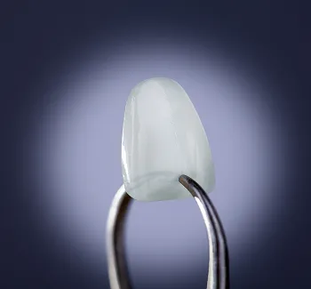 Dental Veneers
